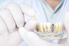 a dentist showing a model of a dental implant